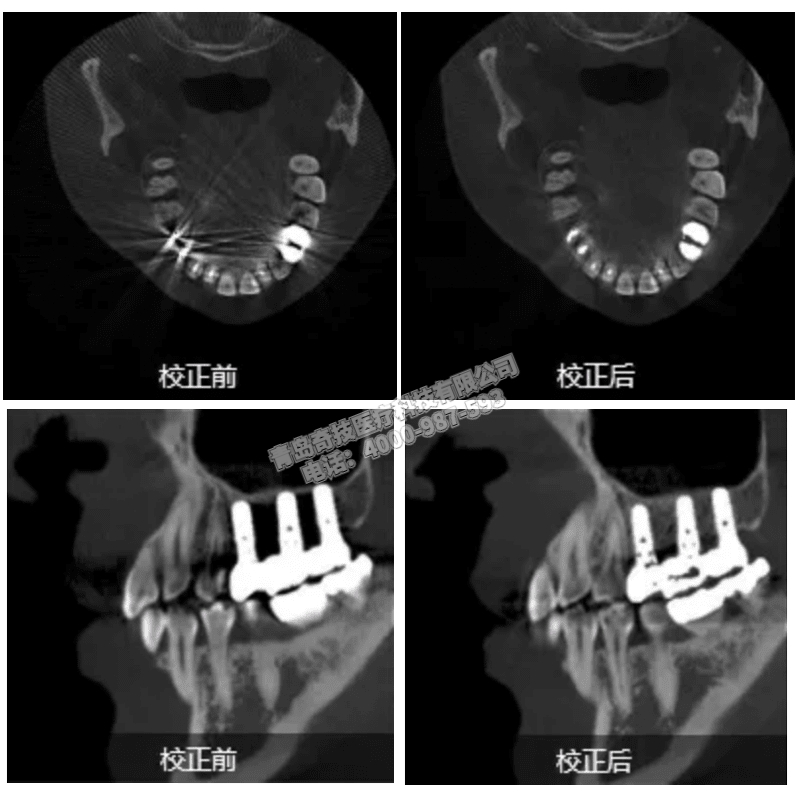 ǻCBCT ȫC(j)LARGEVa(chn)ҕa(chn)ƷB