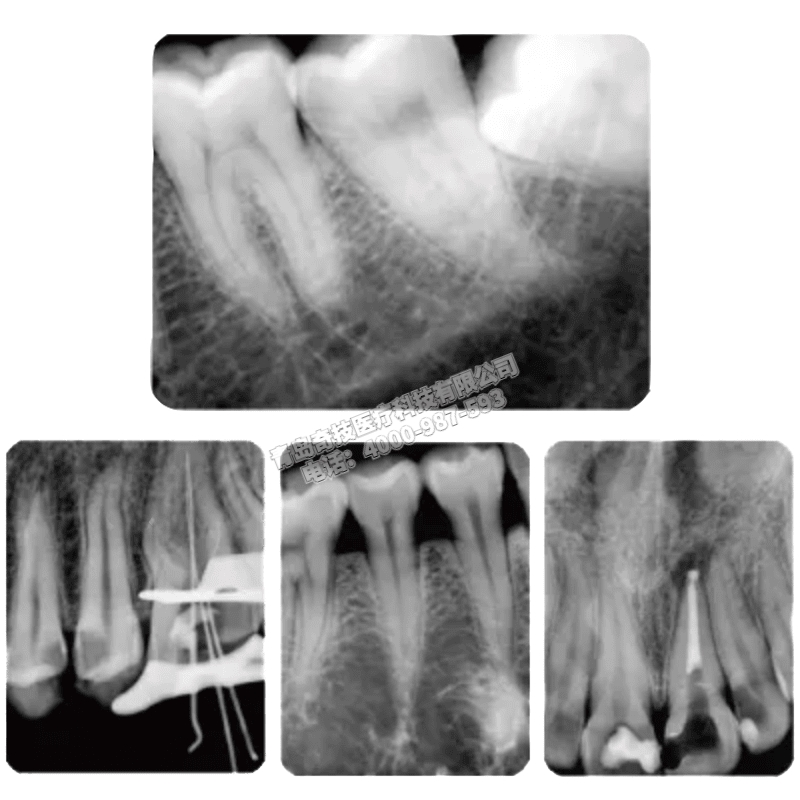 CǻCBCT ȫC(j)LARGEVa(chn)ҕa(chn)ƷB