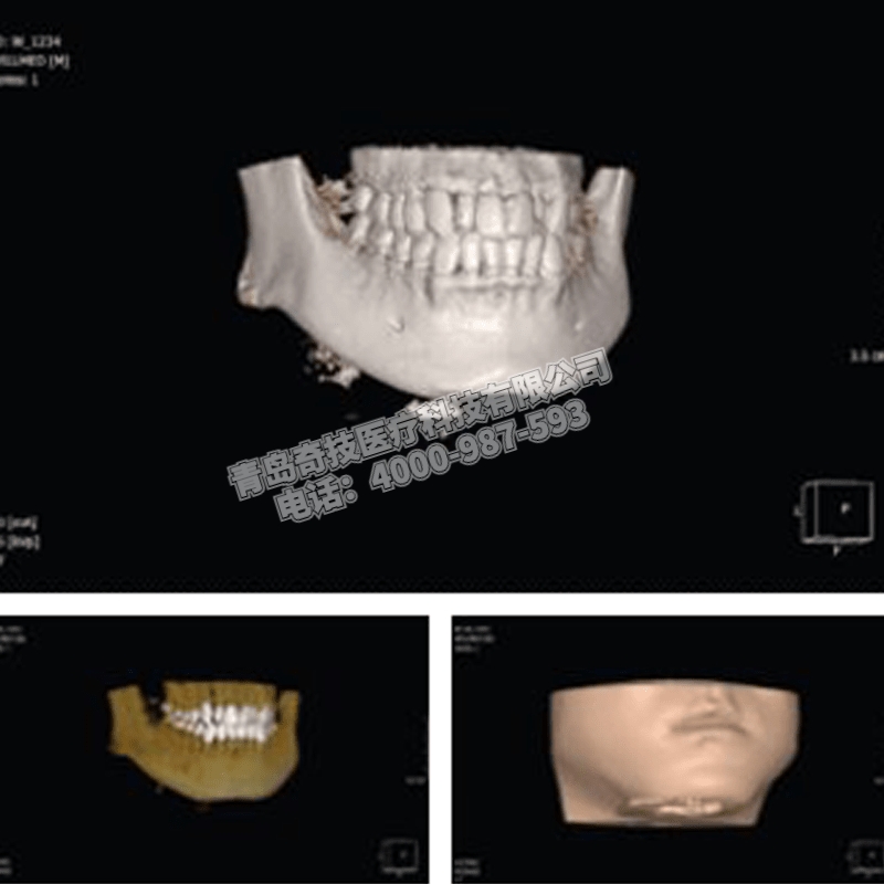 ϿǻCBCT ǻȫC(j)n(gu)HDXa(chn)ƷB