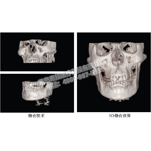 新疆坐式大視野HDX WillDENTRI口腔全景機牙科CBCT維修