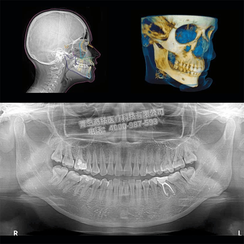 北京CS9300銳珂口腔全景機(jī)二手牙科CT