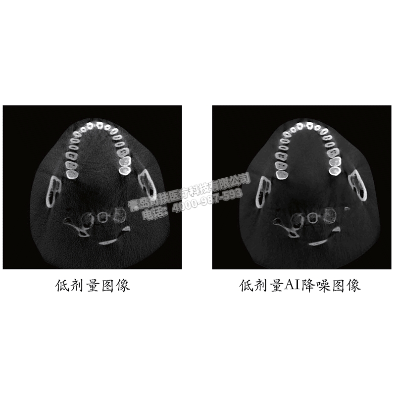 V|ǻCBCT ǻȫC(j)خa(chn)ƷB