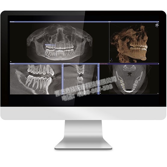 ȫǻCBCT ǻȫC(j)Z®a(chn)ƷB