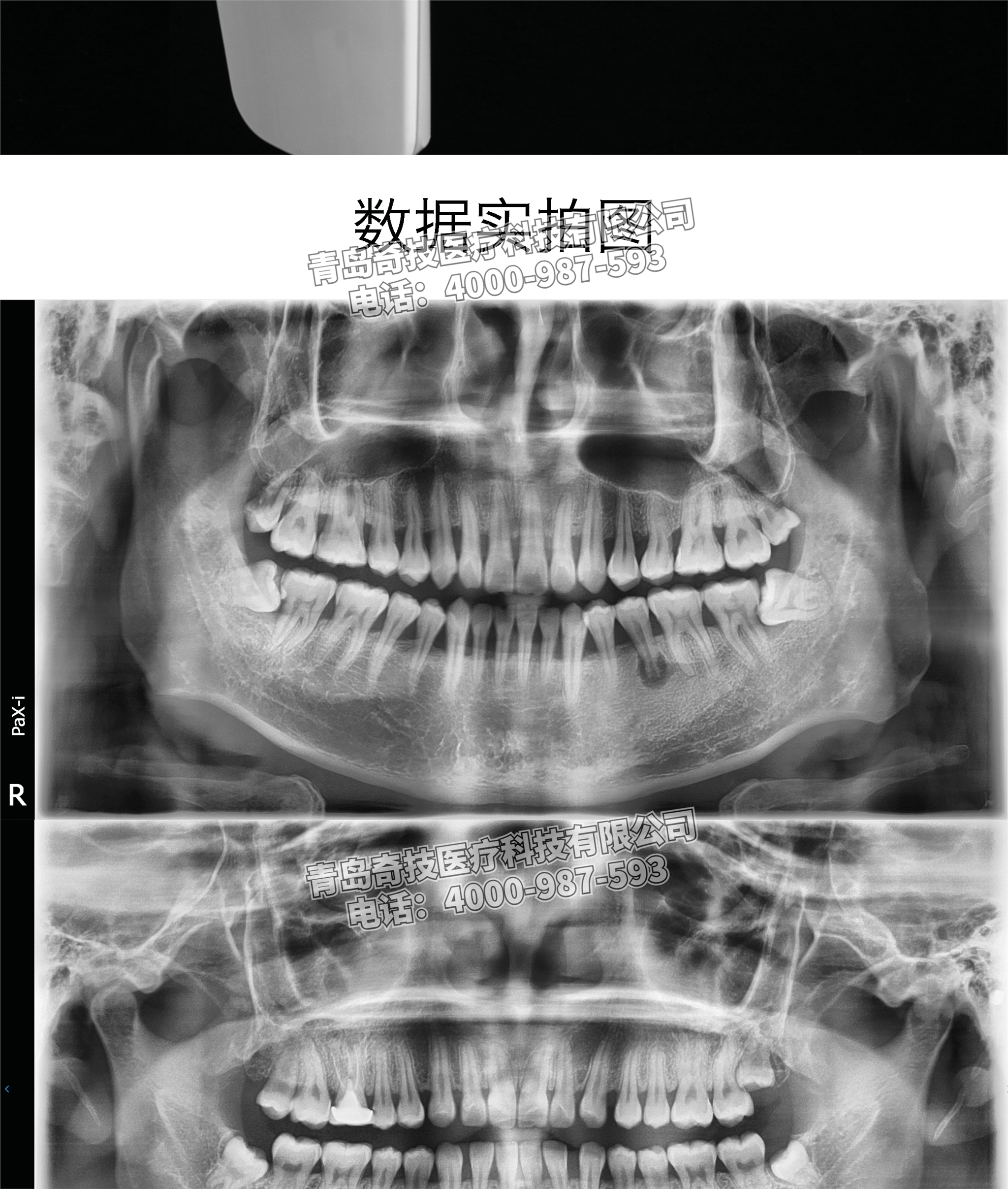 福建轉(zhuǎn)讓韓國怡友二手口腔全景機(jī)牙科CT