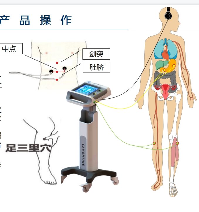 胃腸多功能治療儀-胃腸動力治療儀