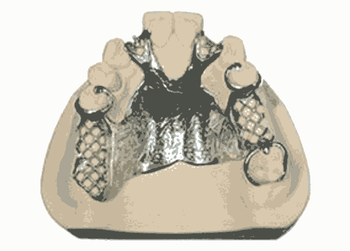 懷柔鈦合金內(nèi)窺鏡手術(shù)器械-無(wú)損傷激光焊接加工廠家地址