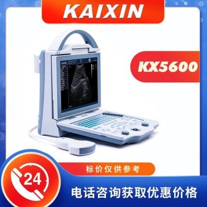 凱信供應便攜黑白B超機KX5600\/全數字B型超聲診斷儀