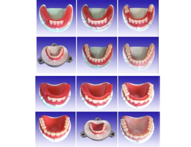 全口制作步驟醫(yī)學(xué)教學(xué)模型